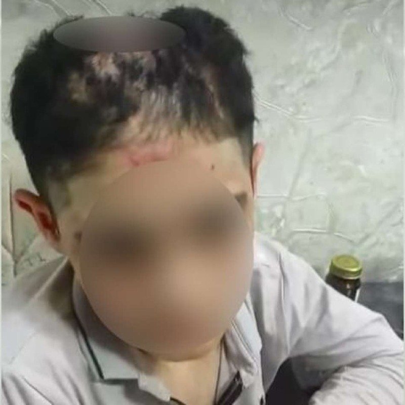 İşgəncəyə məruz qalan uşaq səhiyyə müəssisəsinə yerləşdirilib - RƏSMİ