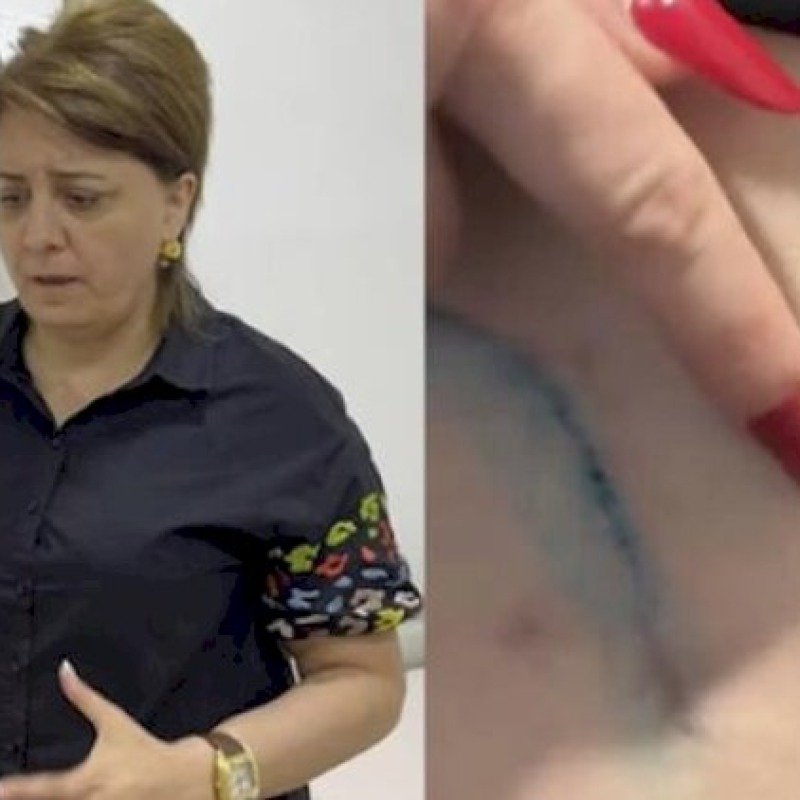 “MedAura” klinikasında saxta estetik cərrah: “Bədənim çürüyür”