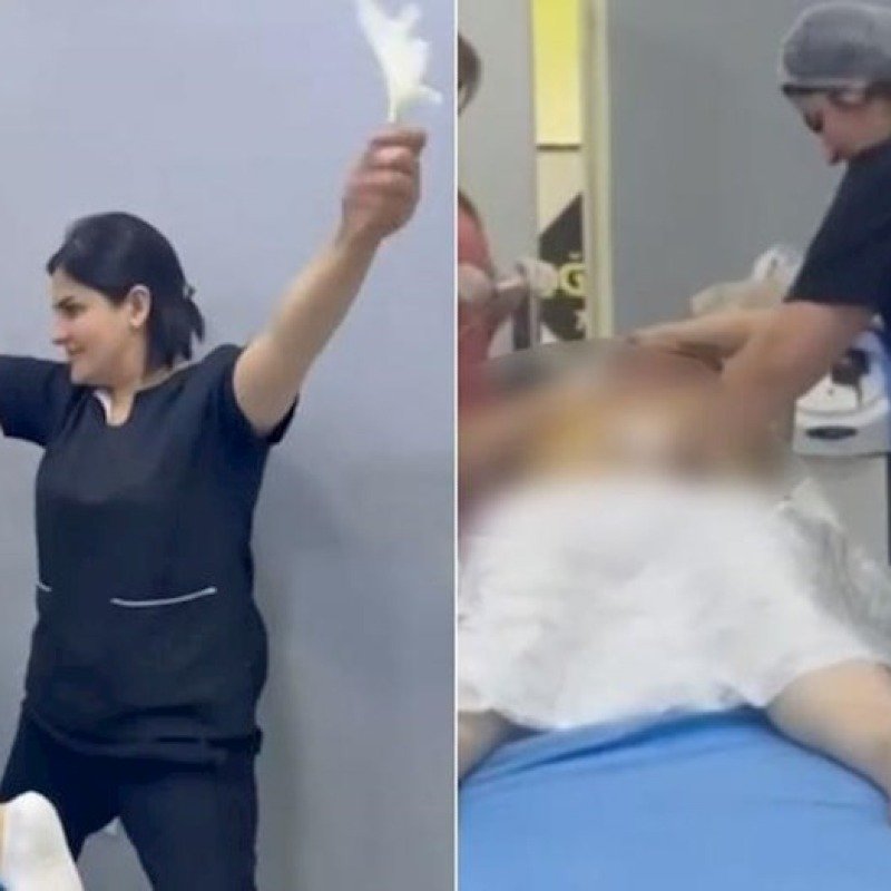 Prokurorluq estetik əməliyyat proseduru ilə bağlı yayılan görüntünü araşdırır