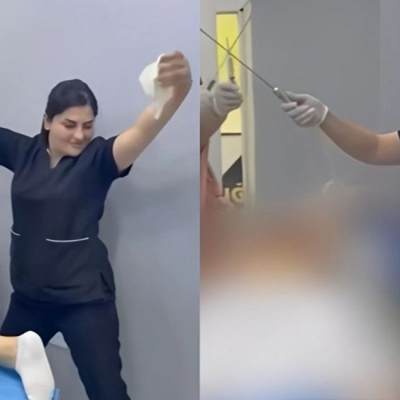 "Dost Estetik Mərkəzi"ndə əməliyyat zamanı qeyri-etik görüntüləri yayılan "həkim" DANIŞDI
