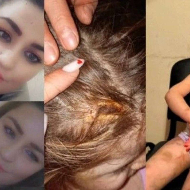 Bakıda ananın 4 yaşlı qızına verdiyi işgəncələr: Bədəni yandırılıb, kəmərlə döyülüb - TƏFƏRRÜAT