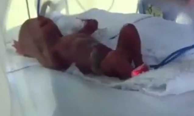 Bakıda çəkisi 370 qram olan uşaq doğuldu – Ailəsi istəmədi